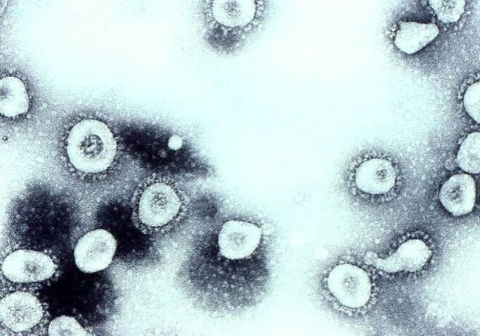 coronavirus